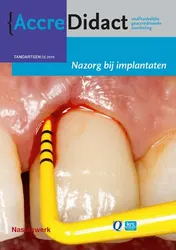 Omslag van Nazorg bij implantaten