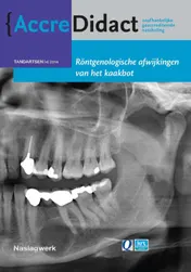 Omslag van Rontgenologische afwijkingen van het kaakbot