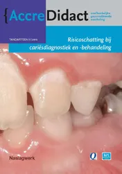 Omslag van Risicoschatting bij cariësdiagnostiek en -behandeling gebaseerd op risicoschatting