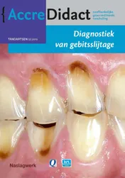 Omslag van Diagnostiek van gebitsslijtage
