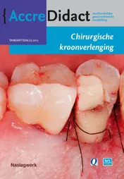 Omslag van Chirurgische kroonverlenging