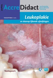Omslag van Leukoplakie en daarop lijkende afwijkingen
