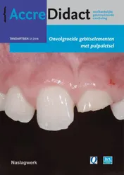 Omslag van Onvolgroeide gebitselementen met pulpaletsel
