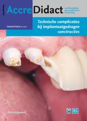 Omslag van Technische complicaties bij implantaatgedragen constructies