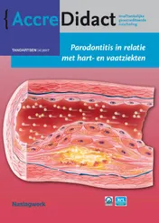 Omslag van Parodontitis in relatie met hart- en vaatziekten