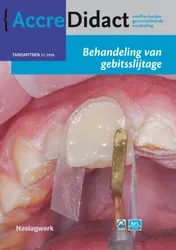Omslag van Behandeling van gebitsslijtage