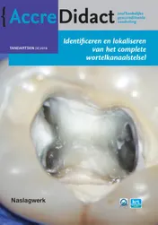 Omslag van Identificeren en lokaliseren van het complete wortelkanaalstelsel