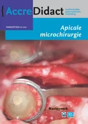 Omslag van Apicale microchirurgie