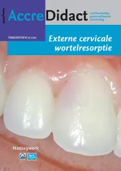 Omslag van Externe cervicale wortelresorptie