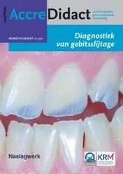 Omslag van Diagnostiek van gebitsslijtage