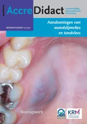 Omslag van Aandoeningen van mondslijmvlies en tandvlees