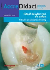Omslag van Vitaal houden van de pulpa