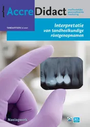 Omslag van Interpretatie van tandheelkundige röntgenopnamen