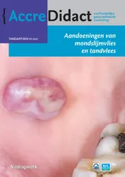 Omslag van Aandoeningen van mondslijmvlies en tandvlees