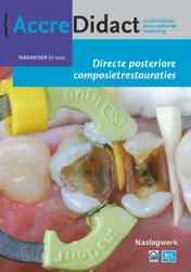 Omslag van Directe posteriore composietrestauraties