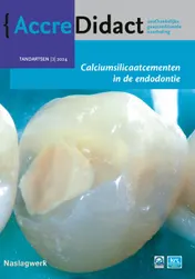 Omslag van Calciumsilicaatcementen in de endodontie