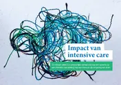 Omslag van Impact van intensive care