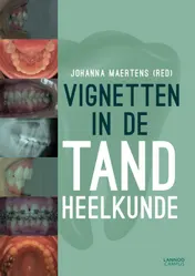 Omslag van Vignetten in de tandheelkunde