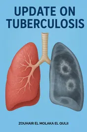Omslag van Update on tuberculosis