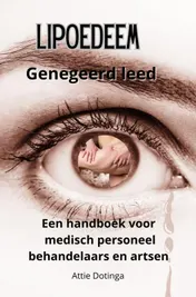 Omslag van Lipoedeem