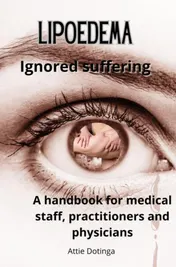 Omslag van Lipoedema