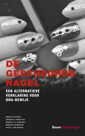 Omslag van De gescheurde nagel