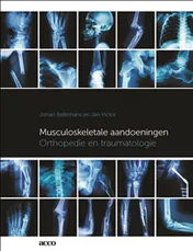 Omslag van Musculoskeletale aandoeningen