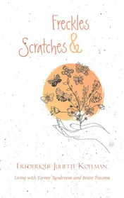 Omslag van Freckles and Scratches
