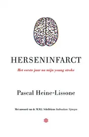 Omslag van Herseninfarct