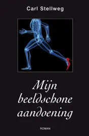 Omslag van Mijn beeldschone aandoening