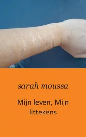 Omslag van Mijn leven, mijn littekens