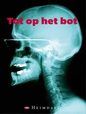 Omslag van Tot op het bot