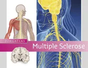 Omslag van Multiple Sclerose