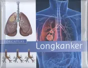 Omslag van Longkanker