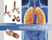 Omslag van Astma en COPD