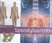 Omslag van Zorgatlas Spondyloartritis