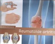 Omslag van Zorgatlas Reumatoïde artritis