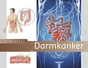 Omslag van Zorgatlas Darmkanker