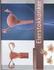 Omslag van Zorgatlas Eierstokkanker