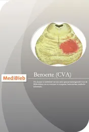 Omslag van Dossier beroerte