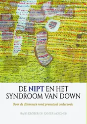 Omslag van De NIPT en het syndroom van Down