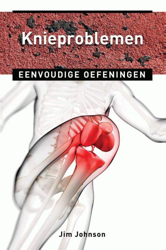 Omslag van Knieproblemen