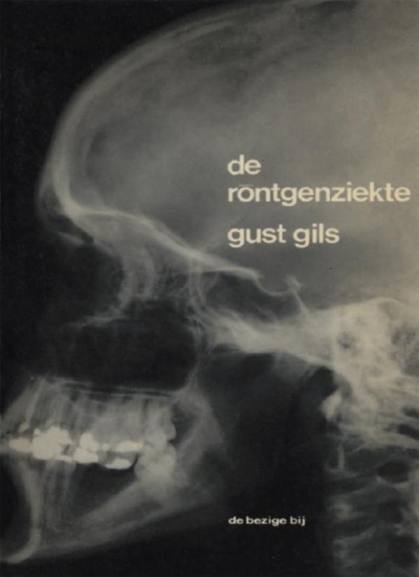 Omslag van De röntgenziekte