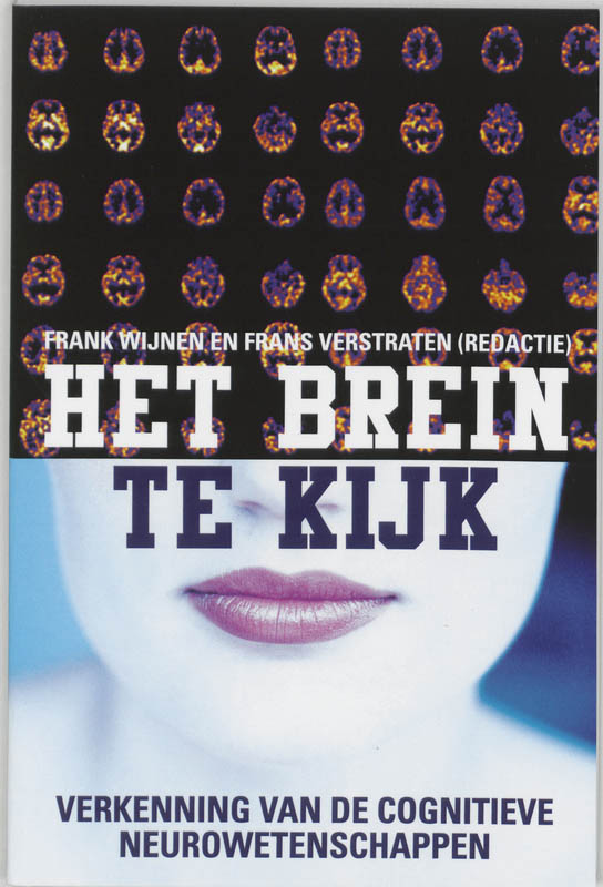 Omslag van Het brein te kijk