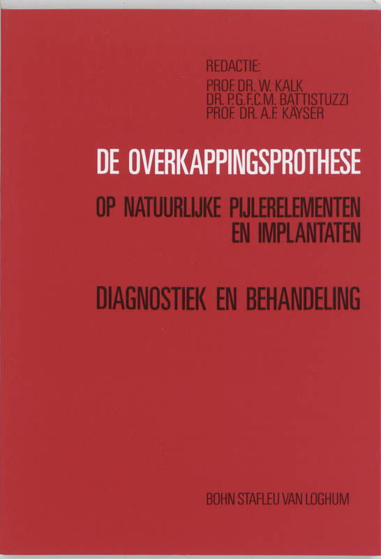 Omslag van De overkappingsprothese op natuurlijke pijlerelementen en implantaten
