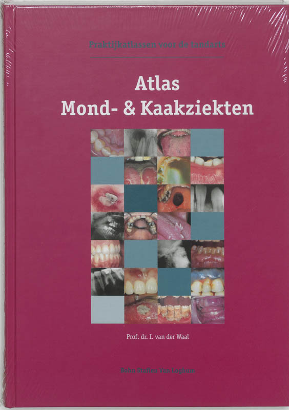 Omslag van Atlas mond- & kaakziekten
