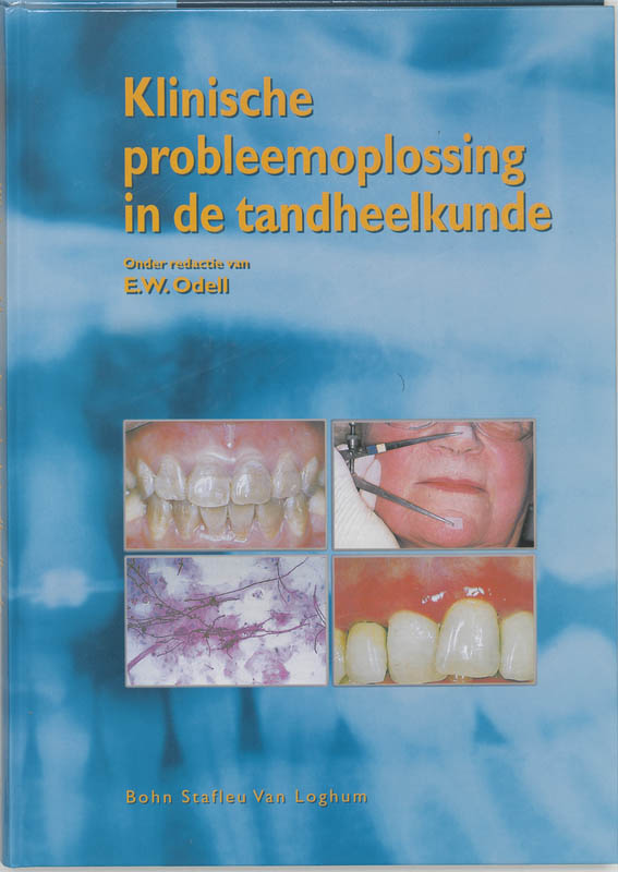 Omslag van Klinisch probleemoplossen in de tandheelkunde