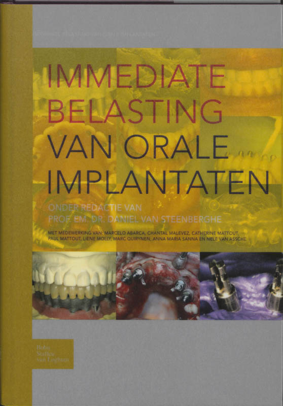 Omslag van Immediate belasting van orale implantaten