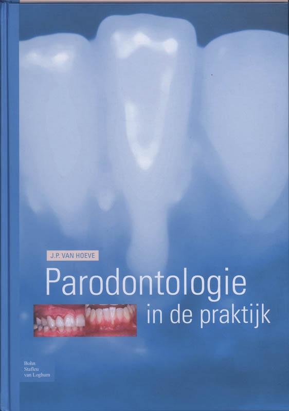 Omslag van Parodontologie in de Praktijk