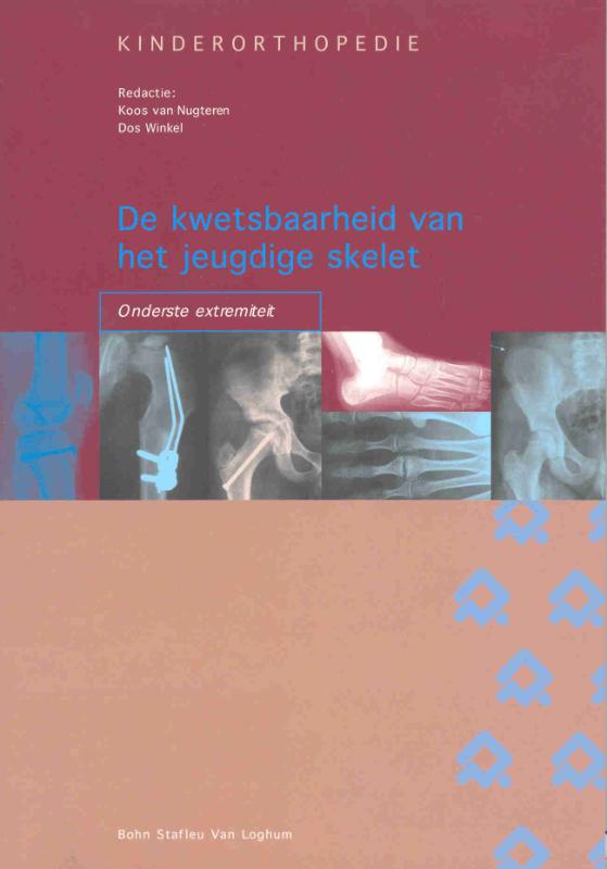 Omslag van Kinderorthopedie